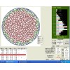 专业定量金相分析软件