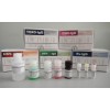 弓形虫IgM抗体检测试剂盒